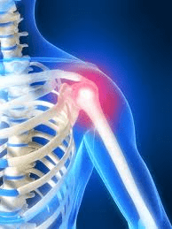 shoulder pain