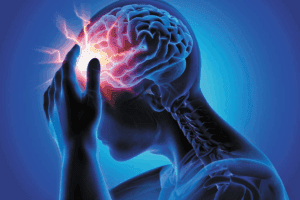 headache in the front of the head